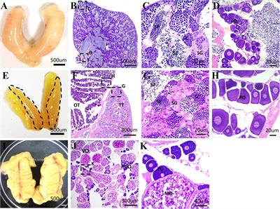 Gonadal Transcriptome Analysis of Sex-Related Genes in the Protandrous Yellowfin Seabream (Acanthopagrus latus)